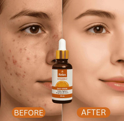 Relax Vitamin C Daily Face Serum – Brightening
